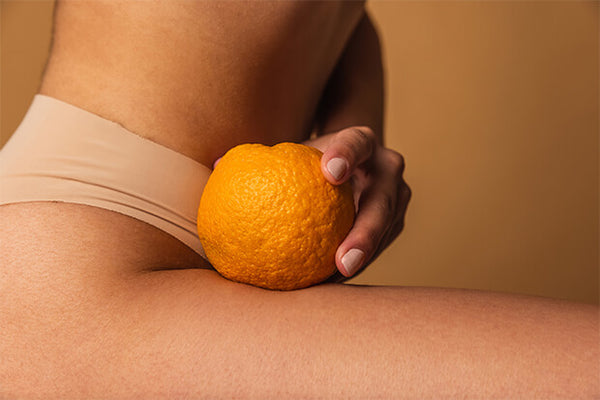 Celulite: o que é, causas, tratamentos e dicas nutricionais