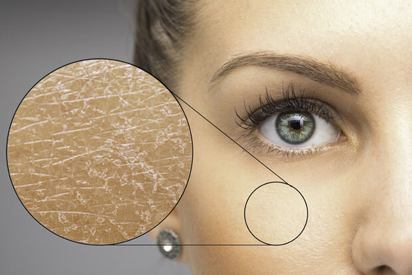 Como a pele pode sofrer os efeitos do estresse e da má alimentação?