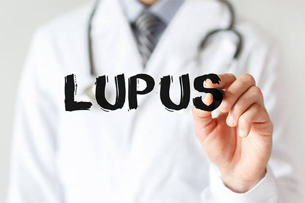 Como o ômega 3 pode ajudar na doença de Lúpus?